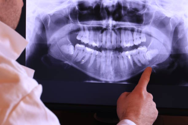 Best Emergency Treatment for Toothache in Lake Leann, MI